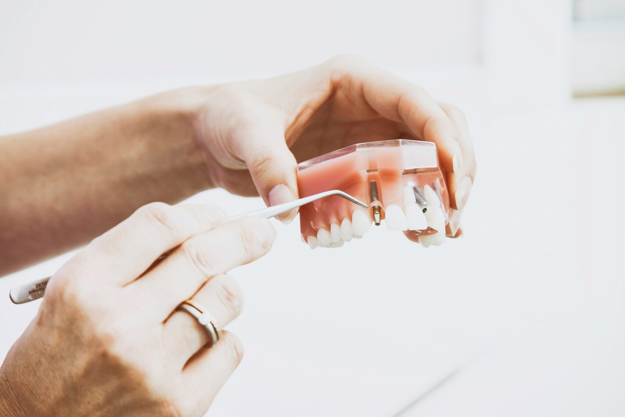 Mines Saint-Étienne lance un double-diplôme "dentiste-ingénieur" (c)Peter Kasprzyk sur Unsplash